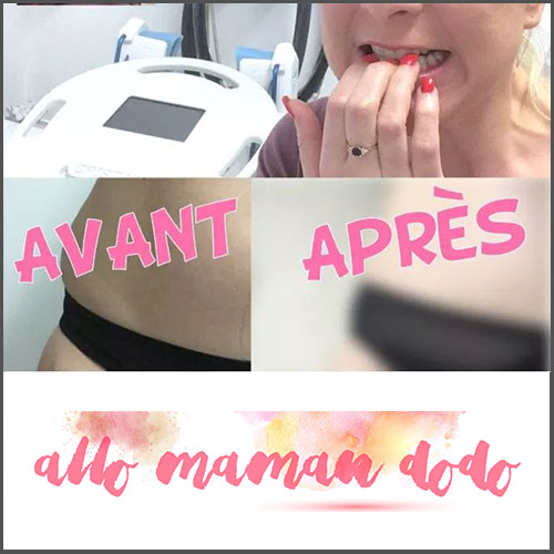 https://www.deleo.fr/allo-maman-dodo