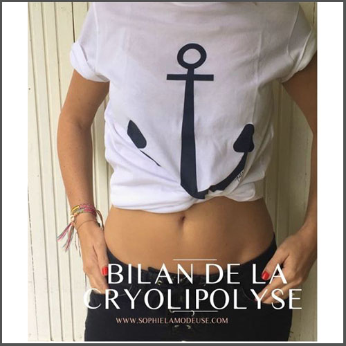 https://www.deleo.fr/BILAN DE LA CRYOLIPOLYSE-sophie-la-modeuse-blog-cryolipolyse-1
